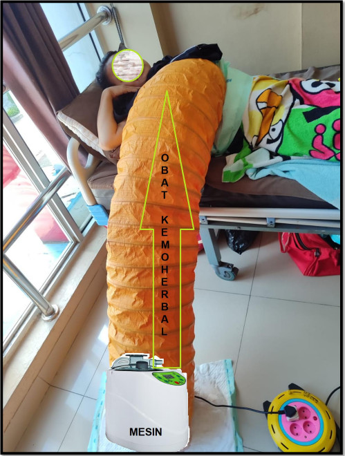 contoh pasien kanker payudara