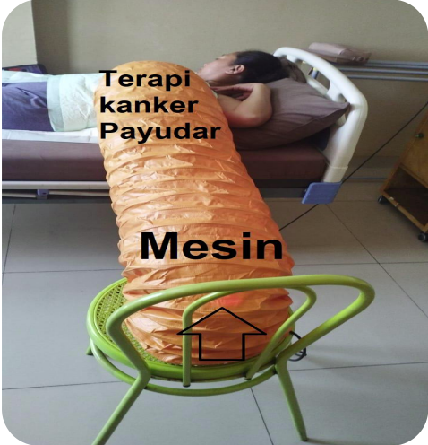 kemoherbal kanker payudara